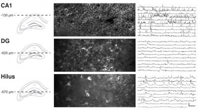 tiago 1 Hippocampus Ca2+ Imaging